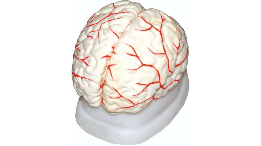 Brain Model & Arterial Supply Plastic