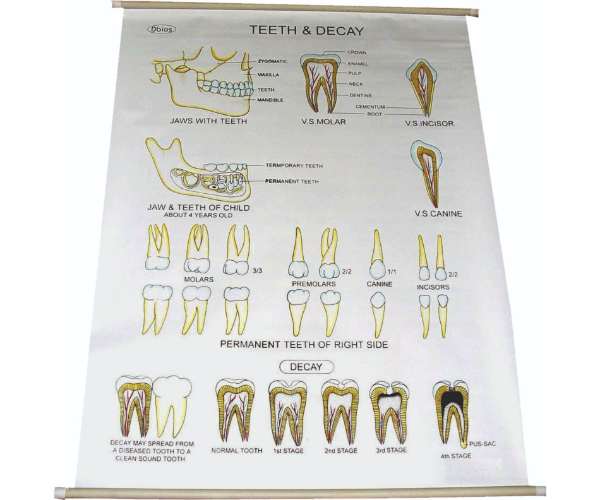 Charts (Polyart Sheet
