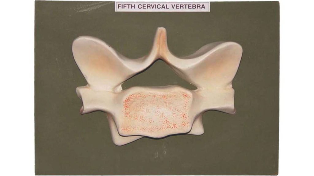 Fifth Cervical Vertebra