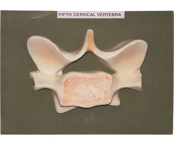 Fifth Cervical Vertebra