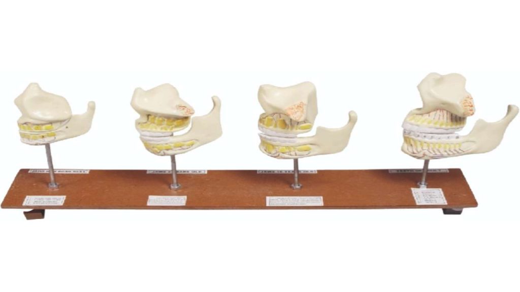 Jaws of New Born Baby