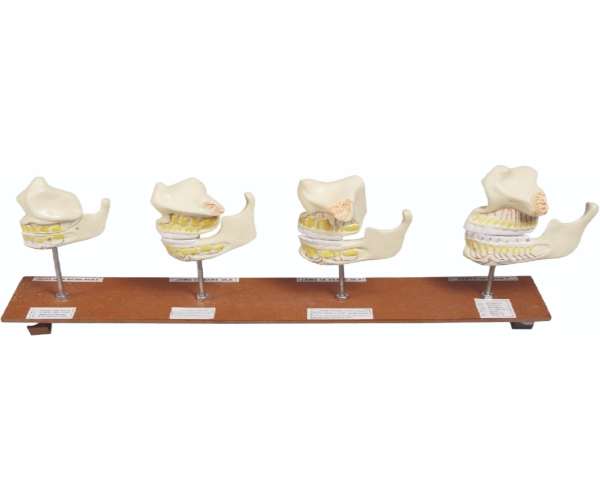 Jaws Of New Born Baby